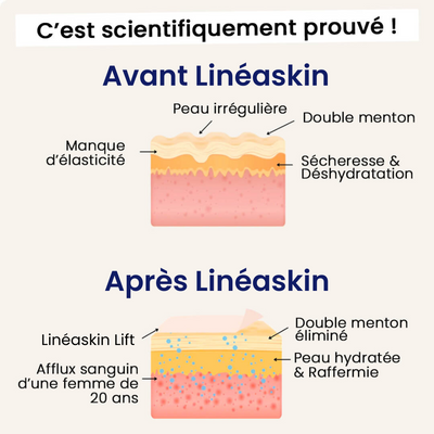 Linéaskin lift: dites adieu à votre double menton dès maintenant