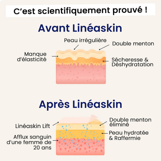 Linéaskin lift: dites adieu à votre double menton dès maintenant